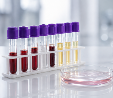 Estudios de Laboratorio Clínico | BioAquim Jalisco